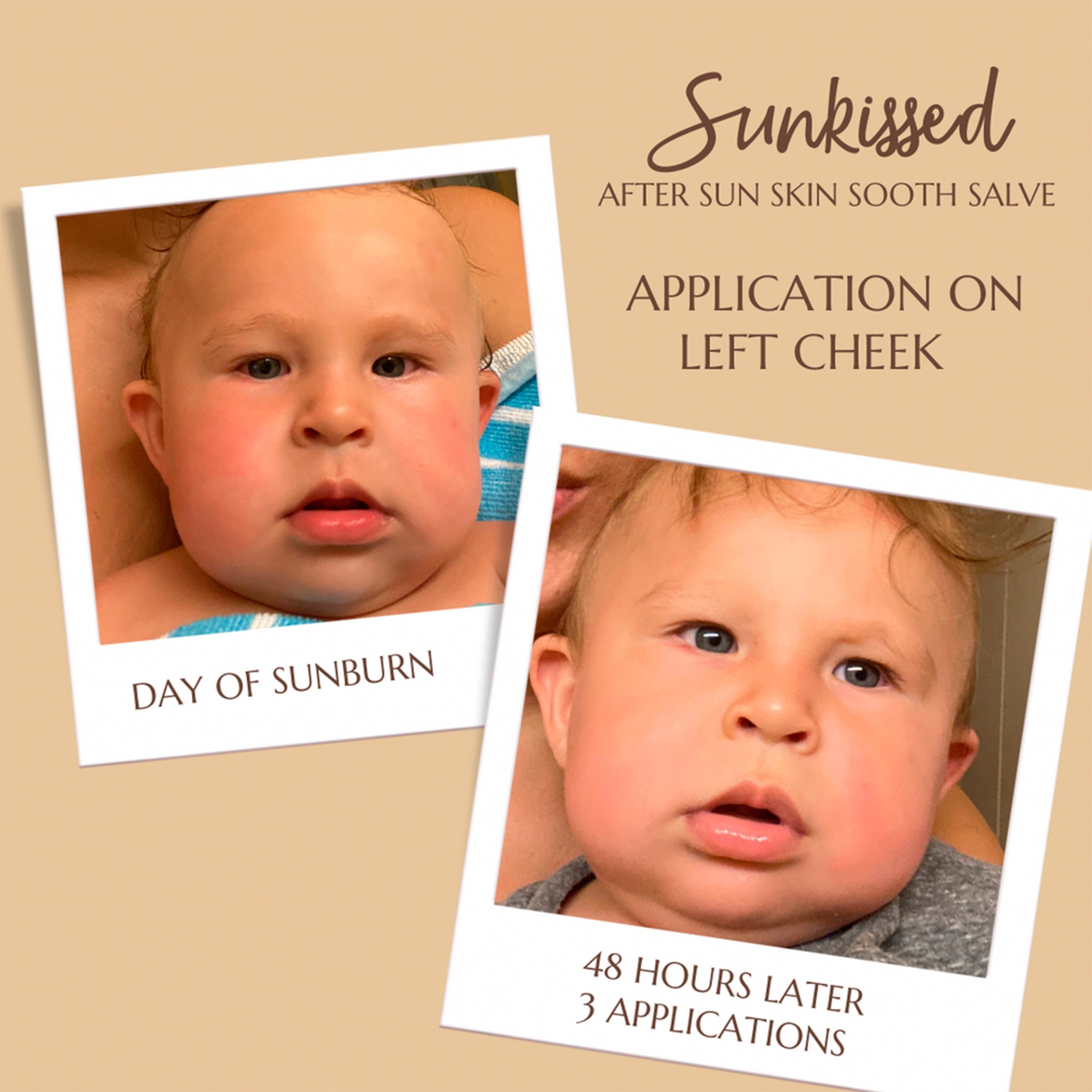 Sunkissed After Sun Soothing Skin Salve Comparison